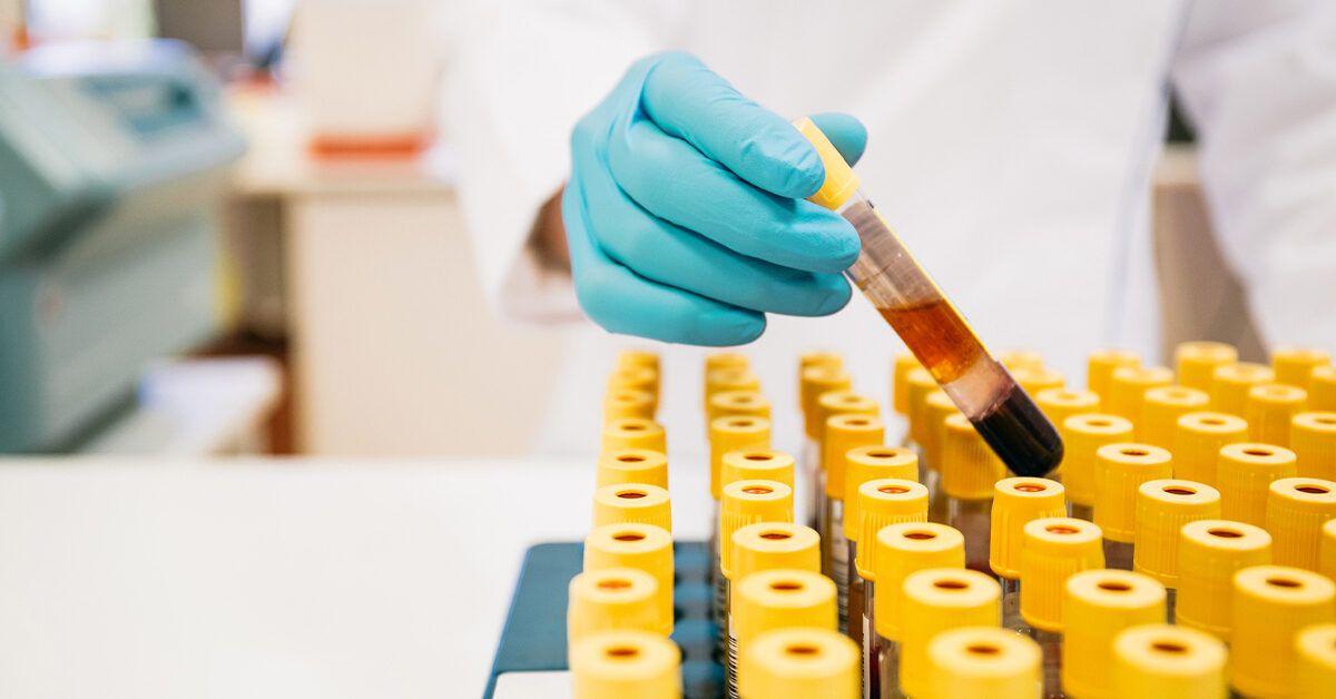 Muha Meds lab tests 2 The Importance of Lab Testing for Muha Meds Products